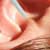 Treating Addictions With Acupuncture